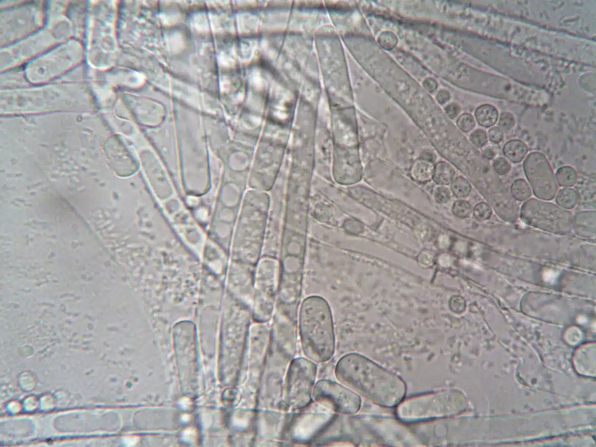 Representación microscópica de la bacteria Vibrio vulnificus causante de infecciones en agua marina
